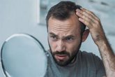 Foto: La terapia con células madre demuestra su eficacia para revertir la alopecia en ratones
