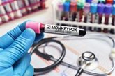 Foto: La OMS advierte sobre el aumento de casos de mpox y mantiene la emergencia de salud pública internacional
