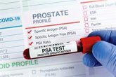 Foto: SOGUG destaca que las tasas de supervivencia de cáncer de próstata alcanzan el 90% si se detecta pronto