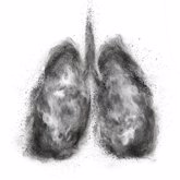Foto: Descubren acumulación de algo parecido al hollín en células pulmonares de pacientes con EPOC