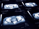 Foto: ANCAP anima a los hombres a hacerse la prueba del tumor de próstata: "El temor al examen es más peligroso que el cáncer"