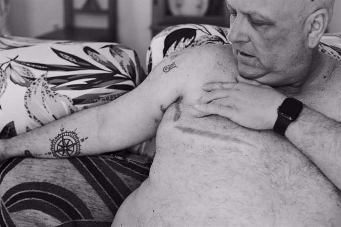 Archivo - INVI celebra la entrada del cáncer de mama masculino en la agenda científica tras años "invisivilizado"