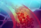 Foto: Investigadores españoles diseñan una nueva estrategia para disminuir los niveles de colesterol en sangre