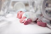 Foto: Infecciones y trastornos neurológicos, principales causas de muerte tras complicaciones neonatales