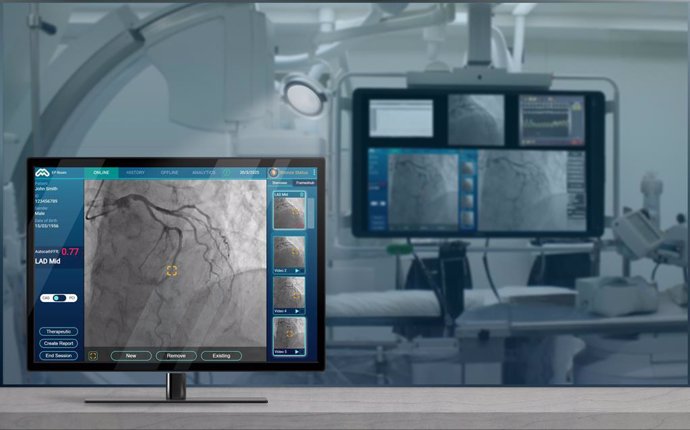 AutocathFFR in Action - An AI Powerhouse in the Cath Lab