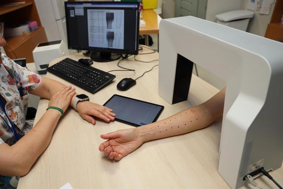 Nueva herramienta de diagnóstico de alergias cutáneas en el Hospital de Toledo.