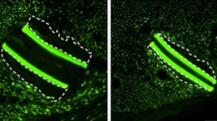Desarrollan una estrategia para mejorar la tolerancia a los implantes protésicos