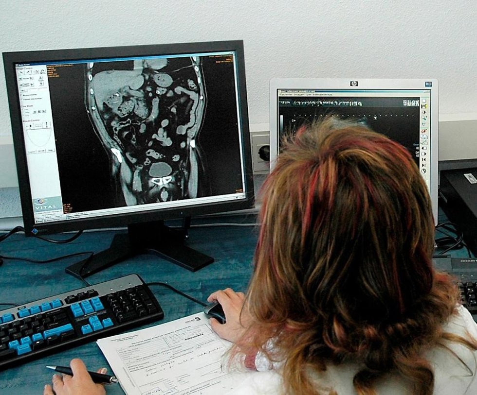 El Gobierno De Castilla-La Mancha Adjudica El Contrato Del 'Ykonos VIII' Para Fortalecer La Gestión Y Evolución De La Red De Imagen Médica Digital.