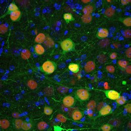 Identifican un grupo de neuronas implicado en la regulación de la ansiedad y los trastornos sociales