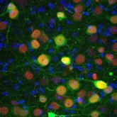 Foto: Descubren un grupo de neuronas clave en la amígdala que regula la ansiedad y la conducta social