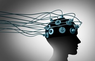 Archivo - Estimulación cerebral.