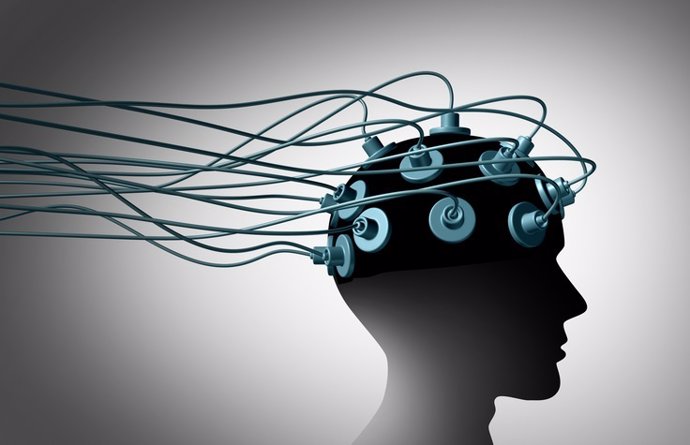 Archivo - Estimulación cerebral.