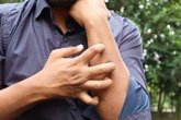 Foto: Las claves para prevenir y actuar ante las principales alergias