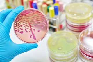 Archivo - Algunas enfermedades, el uso de antibióticos y dietas poco saludables pueden reducir la abundancia y supervivencia de las bacterias intestinales que favorecen nuestra salud.