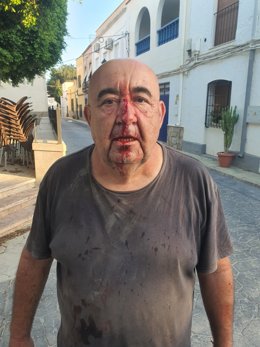 O conselheiro do meio ambiente em Alsodux (Almería), José Manuel Gil, depois de ser atacado com uma pedra no rosto.