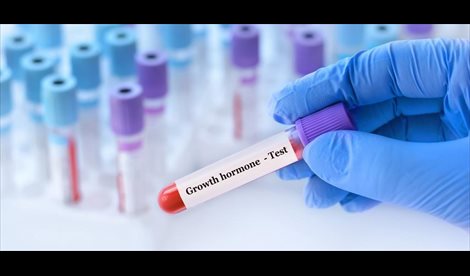 Investigación