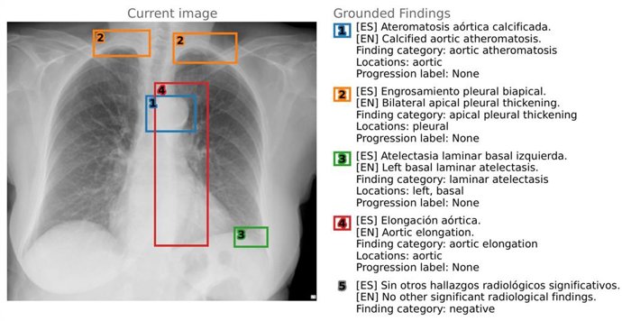 La Universidad de Alicante impulsa un hito en IA médica con el lanzamiento del primer conjunto de datos bilingüe y multimodal