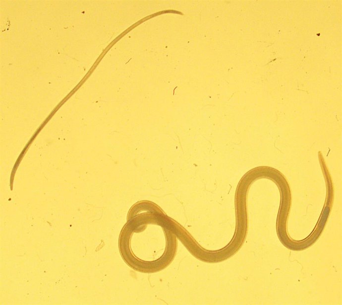 Larvas de anisakis y de Hysterothylacium