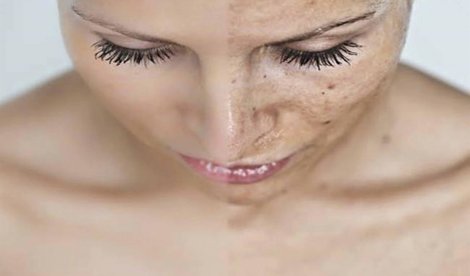 Estética