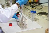 Galicia mejora en convergencia en innovación con la UE, pero sigue por debajo de la media: en el puesto 146 de regiones