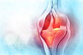 Foto: Una nueva prótesis biónica promete revolucionar la movilidad tras amputaciones por encima de la rodilla