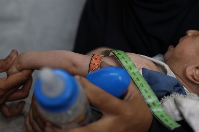 Archivo - Un niño palestino con desnutrición en una clínica de Médicos Sin Fronteras (MSF) en la ciudad de Gaza, en el norte de la Franja de Gaza (archivo)