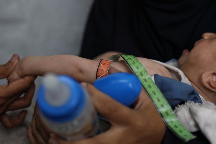 Archivo - Arquivo - Uma criança palestina desnutrida em uma clínica dos Médicos Sem Fronteiras (MSF) na Cidade de Gaza, no norte da Faixa de Gaza (arquivo).