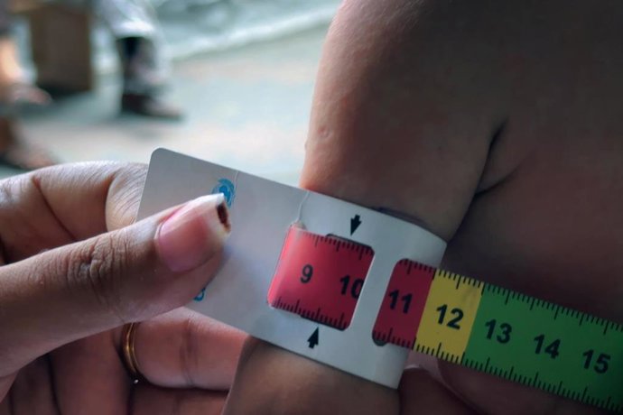 Personal de la Agencia de Naciones Unidas para los Refugiados de Palestina en Oriente Próximo (UNRWA) atiende a un niño palestino con desnutrición en uno de sus centros en la ciudad de Gaza, en el norte de la Franja (archivo)