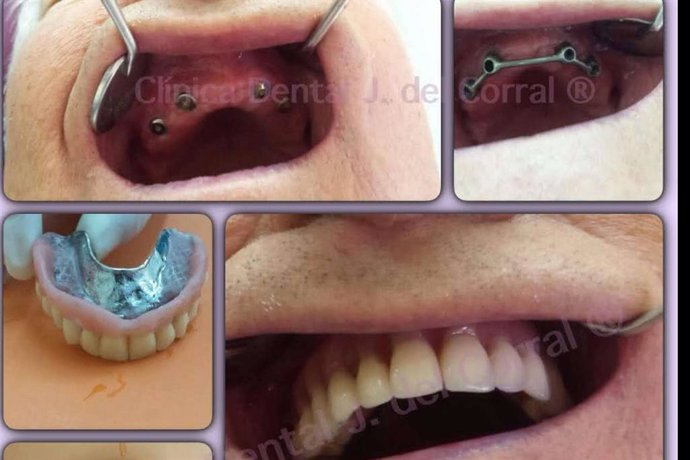 Jorge del Corral, la clínica dental de referencia en Hortaleza para estética y salud bucodental