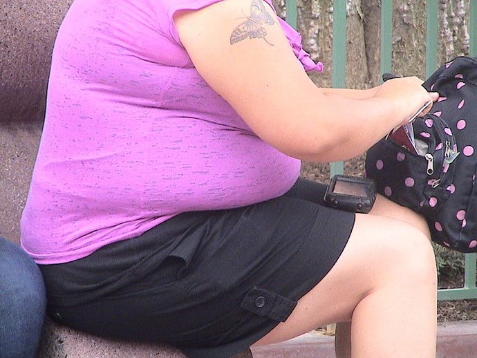 Archivo - obesidad, obeso, obesa, sobrepeso