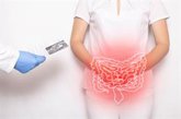 Foto: Acabar con el dolor de la colitis ulcerosa: descubren en papel de la flora intestinal