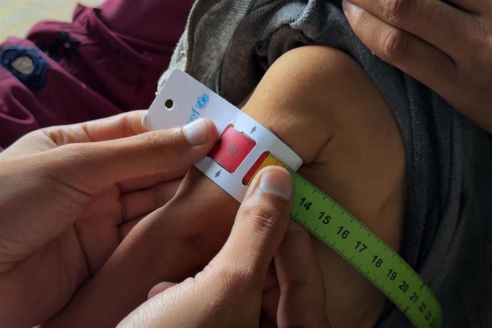 Pruebas a un niño palestino con desnutrición en una clínica de la Agencia de Naciones Unidas para los Refugiados de Palestina en Oriente Próximo (UNRWA) en la Franja de Gaza en medio de la ofensiva militar de Israel (archivo)