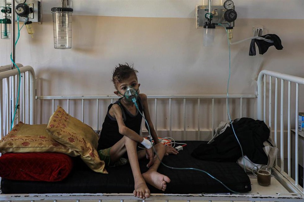 Archivo - Un niño palestino enfermo ingresado en el Hospital Naser de la ciudad de Jan Yunis, en el sur de la Franja de Gaza, en medio de la ofensiva de Israel contra el enclave (archivo)