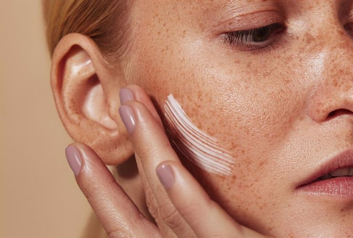 Archivo - Rostro, piel, pecas, cuidado de la piel.
