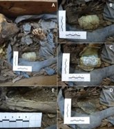 Foto: ¿Cómo se trataba la enfermedad y la muerte en el siglo XIX en Madrid? Una investigación lo desvela