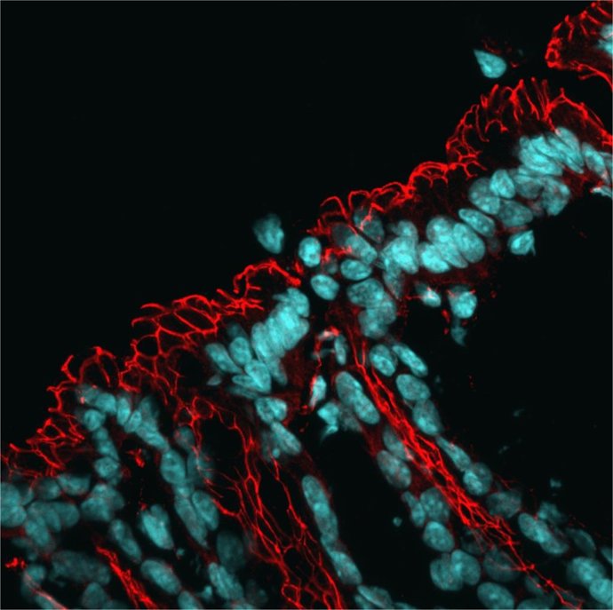 Microscopia do intestino, com os núcleos corados em azul e a rede de proteínas de barreira em vermelho.