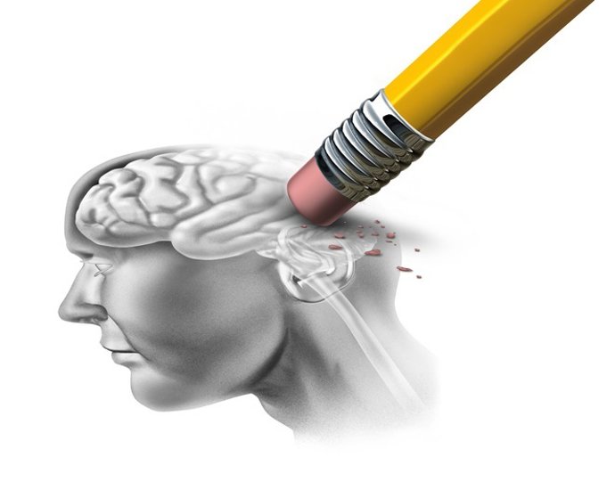 Archivo - Arquivo - Demência, Alzheimer