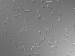 Archivo - Células de ‘Trypanosoma brucei’ en cultivo observadas al microscopio. /