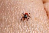 Foto: España notifica tres casos de fiebre hemorrágica de Crimea-Congo en lo que va de año, el último en julio en Toledo