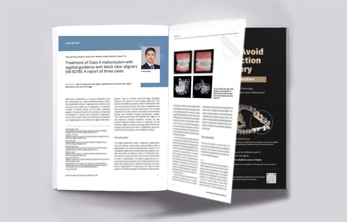 S8-SGTB clear aligner therapy case report