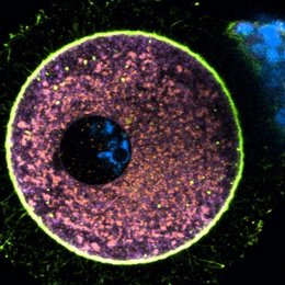 Ovocito humano inmaduro fijado e inmunomarcado con marcadores de orgánulos intracelulares. Las mitocondrias se muestran en naranja, el retículo endoplasmático en lila y el citoesqueleto de actina en verde. El ADN se muestra en azul claro.