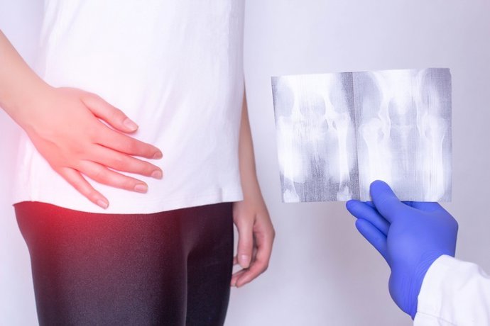 Archivo - Imagen de recurso de una persona con dolor de cadera.