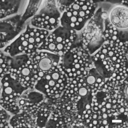 Imagen de microscopía que muestra docenas de vacuolas circulares derivadas de lisosomas.