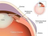 Foto: Desarrollan un 'microstent' con una forma única para combatir el glaucoma