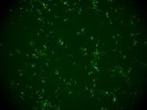Foto: Identifican un mecanismo en gusanos que les ayuda a defenderse frente a reinfecciones de virus