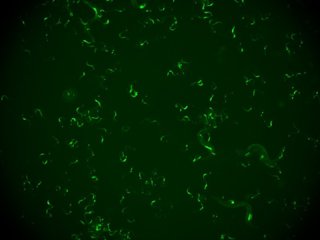 Grupo de 'C. Elegans' infectados visualizados con una lupa. La fluorescencia verde corresponde con las células infectadas y permite distinguir animales infectados de sanos.