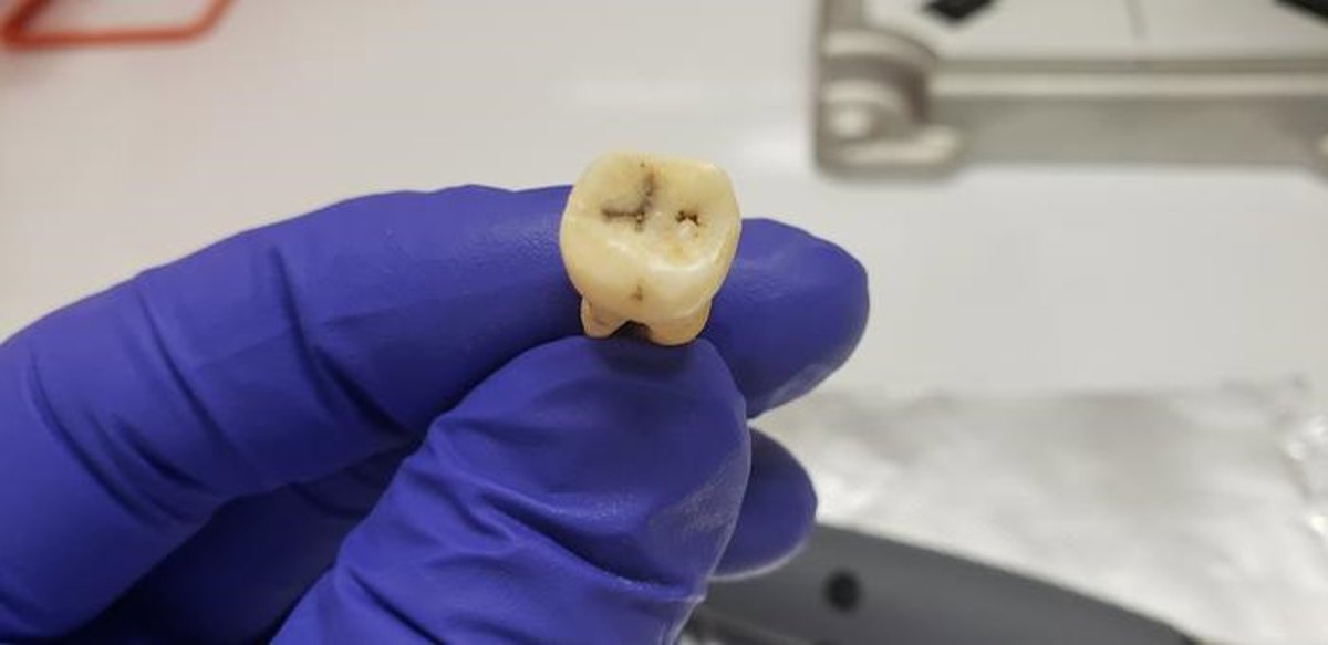 Descubren la bacteria responsable de la primera pandemia registrada, hace 1.500 años