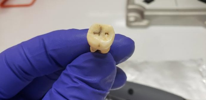 Un investigador sostiene un diente de Jerash utilizado para ayudar a identificar el origen de la primera plaga.