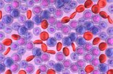 Foto: En 2026 se diagnosticarán 2.111 nuevos casos de leucemia linfocítica crónica en España, según datos de HematoREDECAN