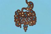 Foto: El trasplante de microbiota fecal podría mejorar la salud de personas con obesidad